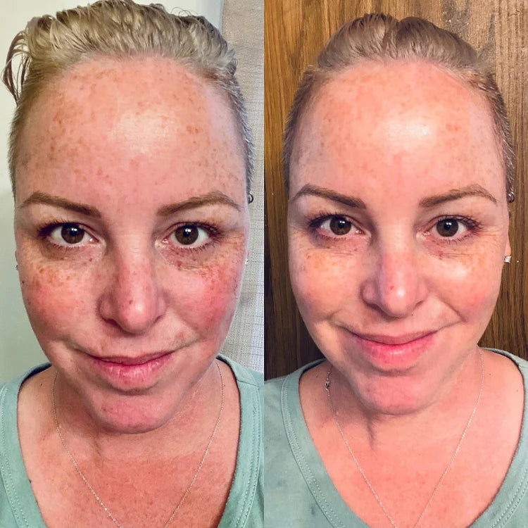 JIYU Toner Pads - Korean Toner Pads Review - Before & After