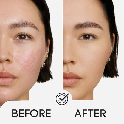 Official & Original Korean Toner Pads Before and After